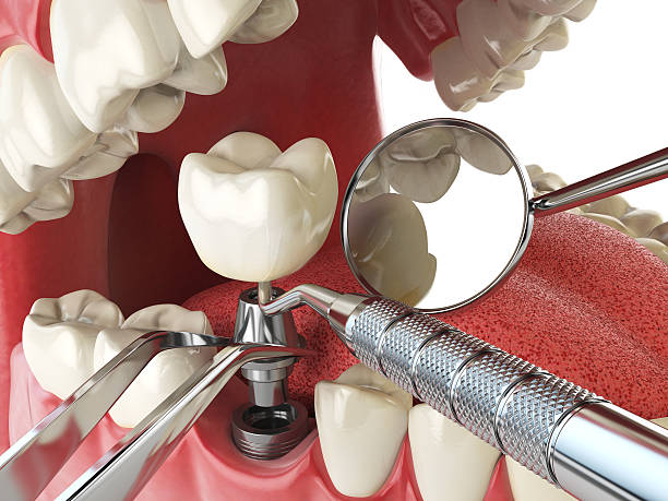 Best Emergency Dental Care for Trauma or Injury in Dahlgren, VA